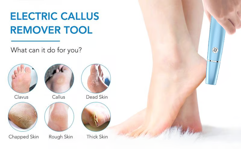 Electric Callus Remover For Smooth Feet And Easy Pedicure Care