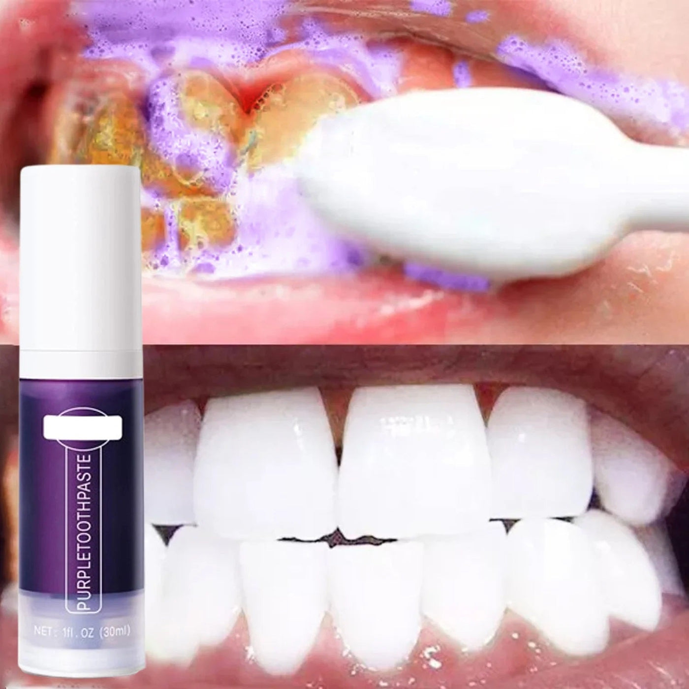 Teeth Whitening Toothpaste With Pro Grade Whitening Strips And Fresh Breath