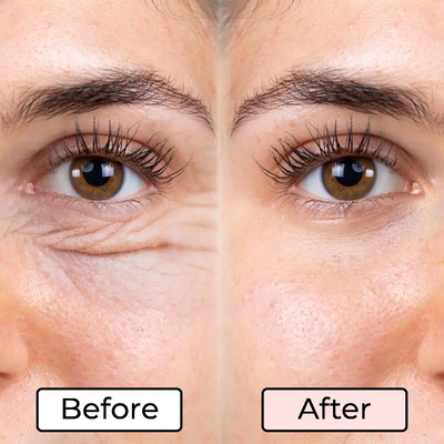 Red Light Therapy Eye Bags Device For Wrinkle And Puffiness Reduction