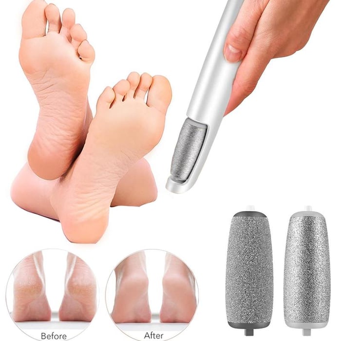 Electric Callus Remover For Smooth Feet And Easy Pedicure Care