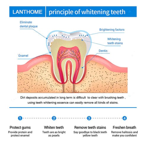 Teeth Whitening Essence For Bright And Sparkling Smile Care