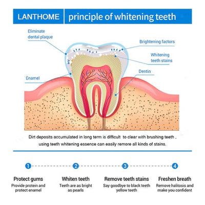 Teeth Whitening Essence For Bright And Sparkling Smile Care