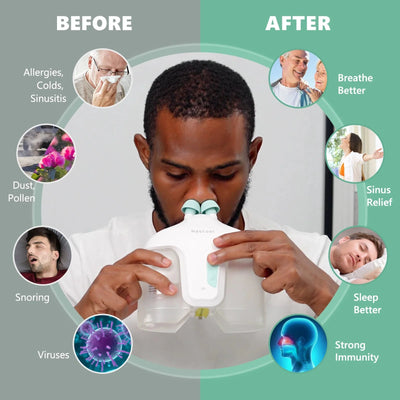 Nascool Electric Nasal Irrigation System With 50 SaltPods Irrigator