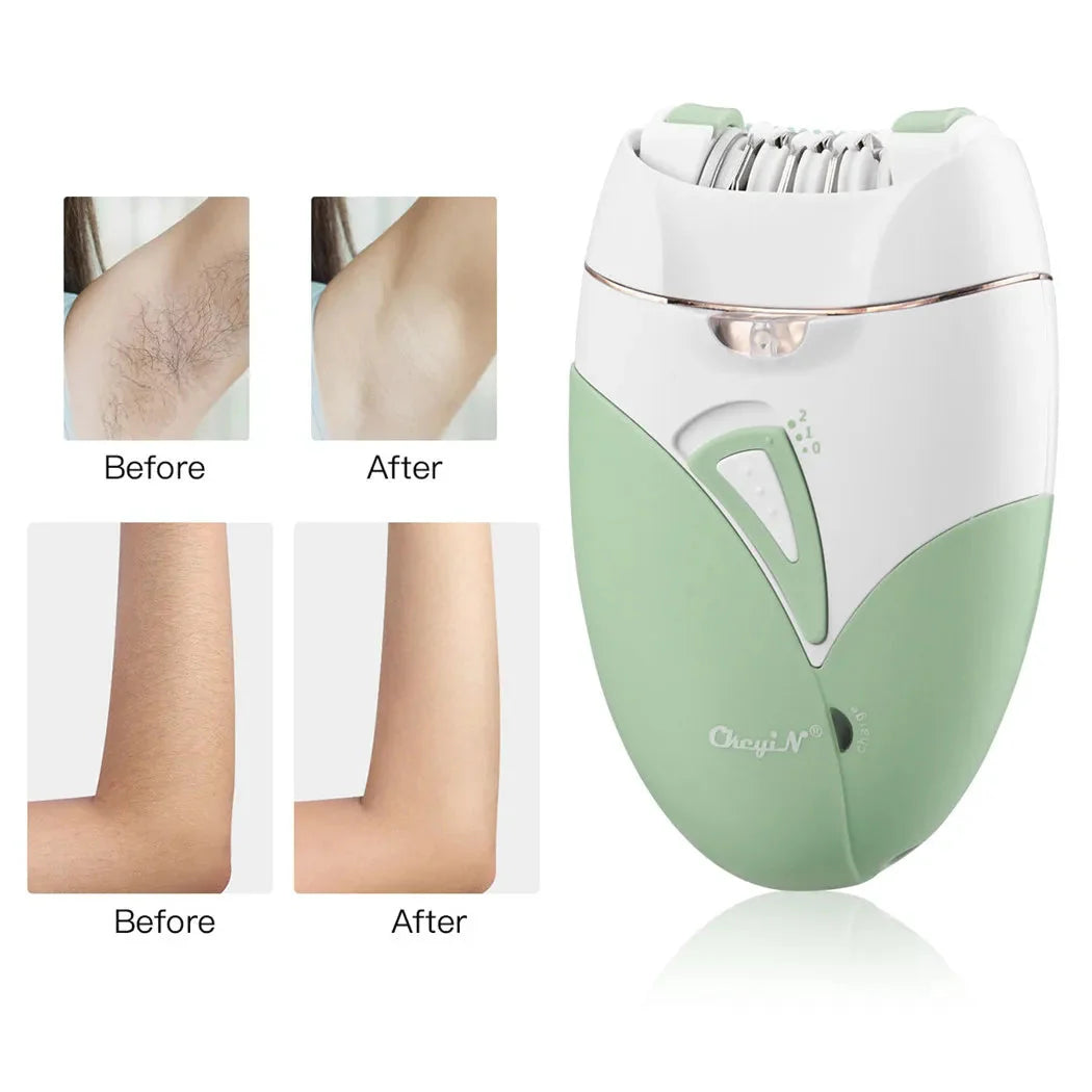 CkeyiN Women's Electric Shaver Painless Hair Removal Device