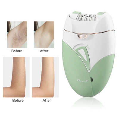 CkeyiN Women's Electric Shaver Painless Hair Removal Device