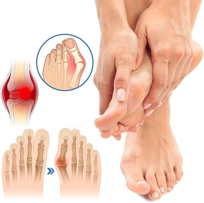 Anti Bunion Socks For Foot Pain Relief And Vein Support Unisex