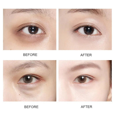 Crystal Gold Collagen Eye Patches For Dark Circles And Hydration
