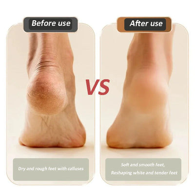 USB Rechargeable Electric Foot Grinder For Callus Removal And Care