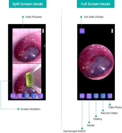 Ear Camera Endoscope 3.9mm Digital Inspector For Android IPhone