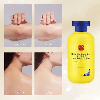 Deep Moisturization Lotion For Itch Relief Non Greasy Formula