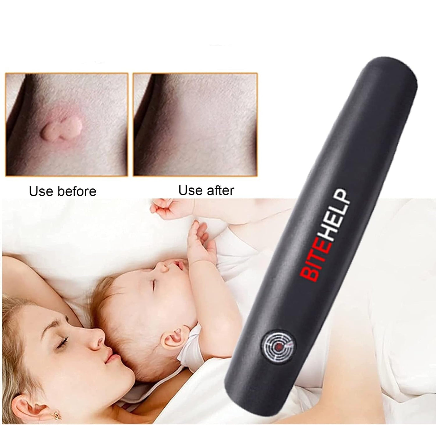 Mosquito Bite Relief Suction Tool For Instant Itch Soothing