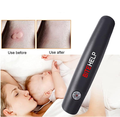 Mosquito Bite Relief Suction Tool For Instant Itch Soothing