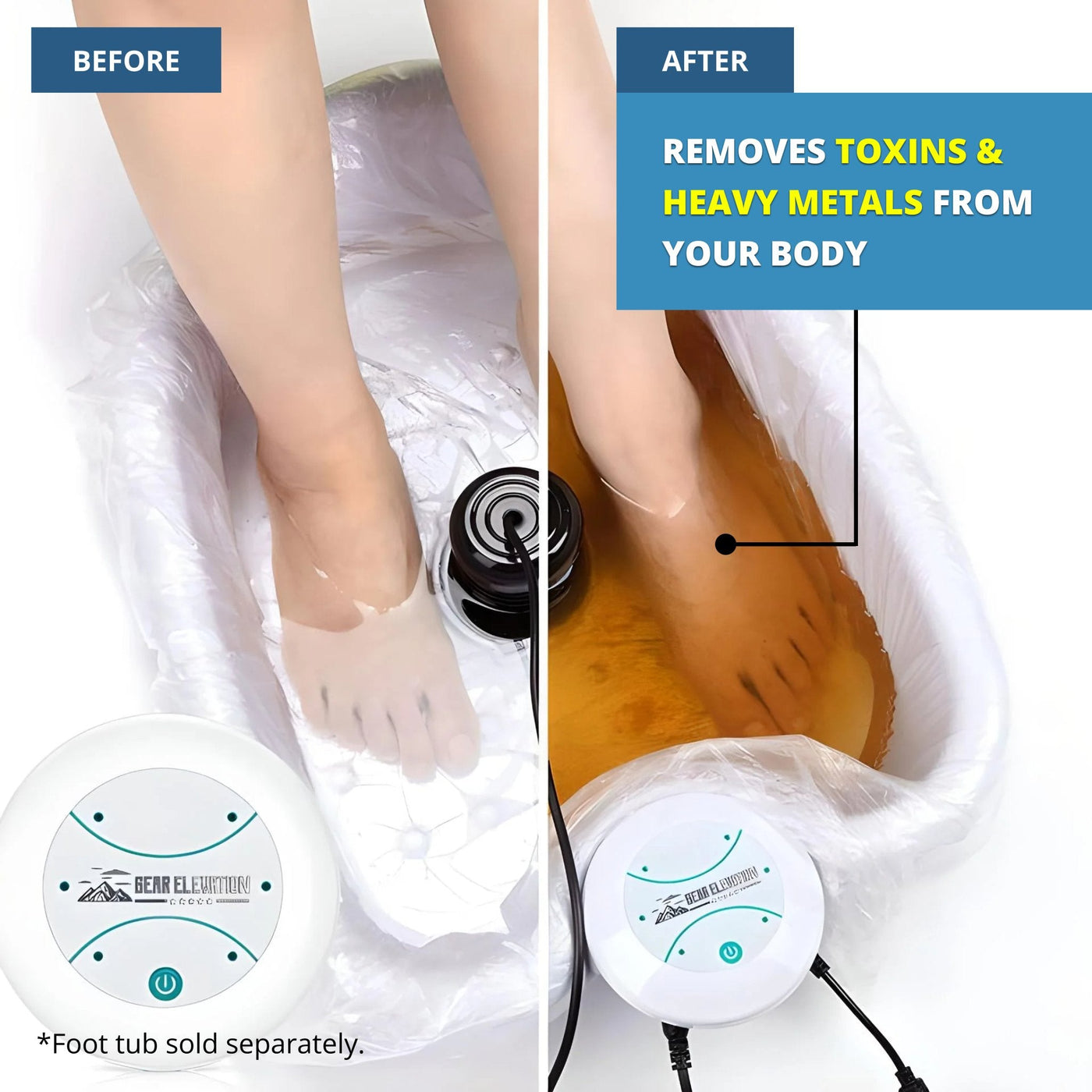 Ionic Detox Foot Bath Machine For Deep Cleansing And Relaxation