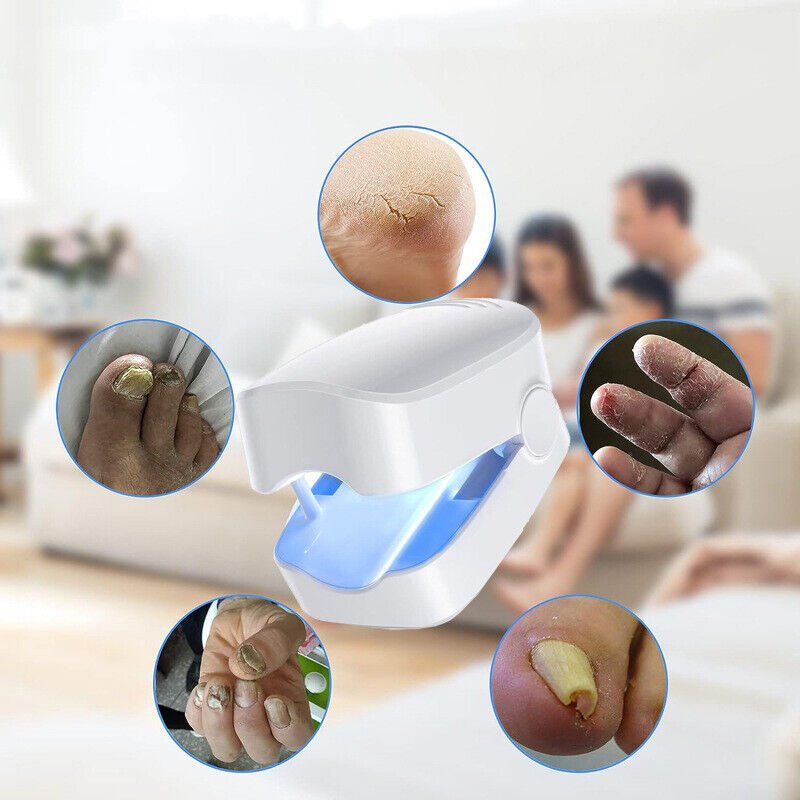 Nail Fungus Laser Device For Effective Toenail Light Therapy Treatment