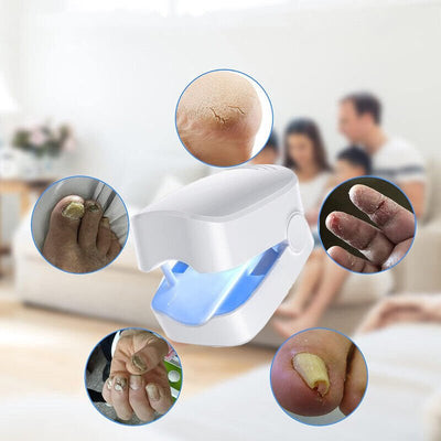 Nail Fungus Laser Device For Effective Toenail Light Therapy Treatment