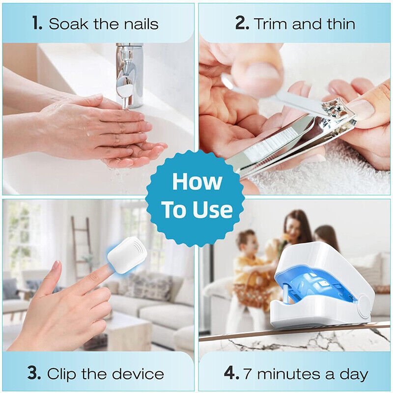 Nail Fungus Laser Device For Effective Toenail Light Therapy Treatment