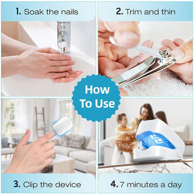 Nail Fungus Laser Device For Effective Toenail Light Therapy Treatment