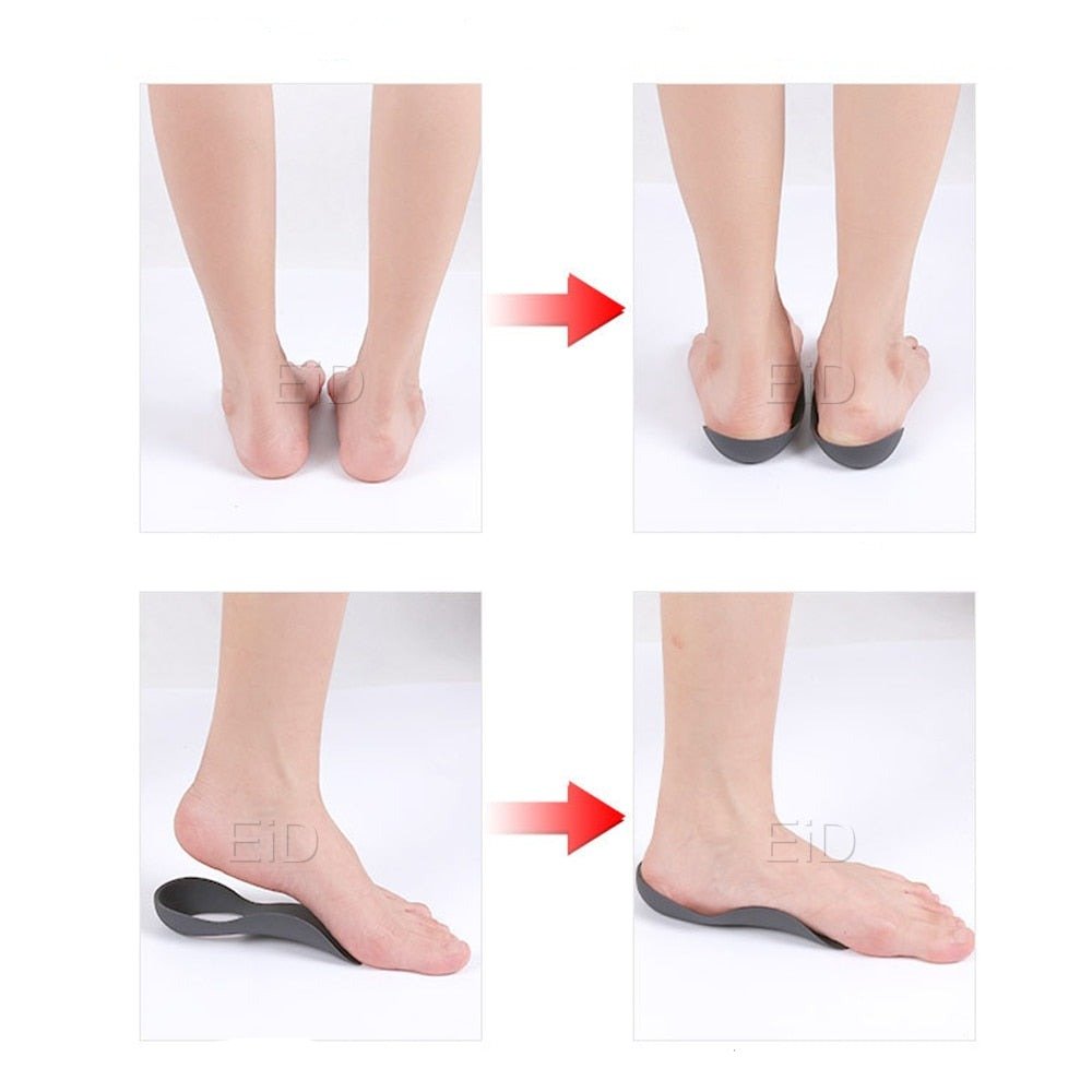 Orthopedic Insoles Arch Support Inserts For Foot Pain Relief