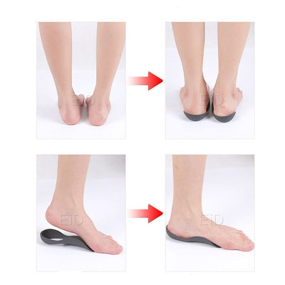 Orthopedic Insoles Arch Support Inserts For Foot Pain Relief