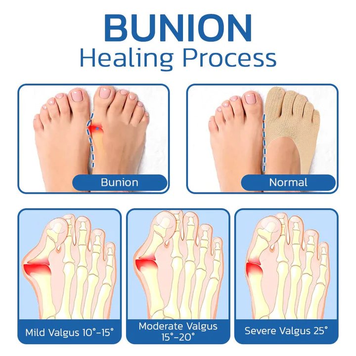 Pro Joint Anti Bunion Socks Cotton Five Finger Low Cut Mesh