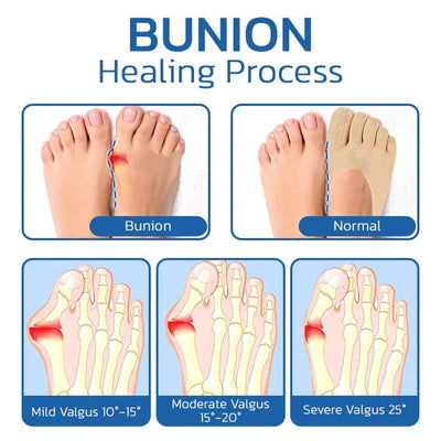 Pro Joint Anti Bunion Socks Cotton Five Finger Low Cut Mesh
