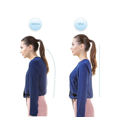 Smart Posture Corrector Neck Hump Straightener For Adults And Kids