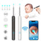 Wireless Earwax Remover Oscope Tool With 1080P Camera Kit